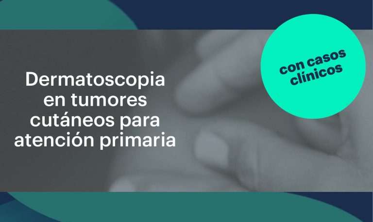 Dermatoscopia En Tumores Cut neos Para M dicos De Atenci n Primaria dermatoscopia-en-tumores-cut-neos-para-m-dicos-de-atenci-n-primaria