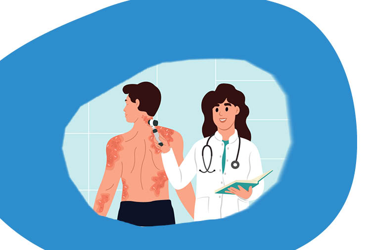 Tratamiento escalonado de la dermatitis atópica 3 Tto escalonado DA