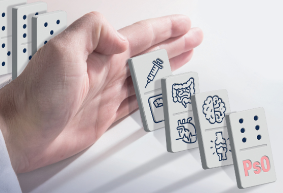 El efecto dominó de la psoriasis 1 20260212 Efecto domino psoriasis